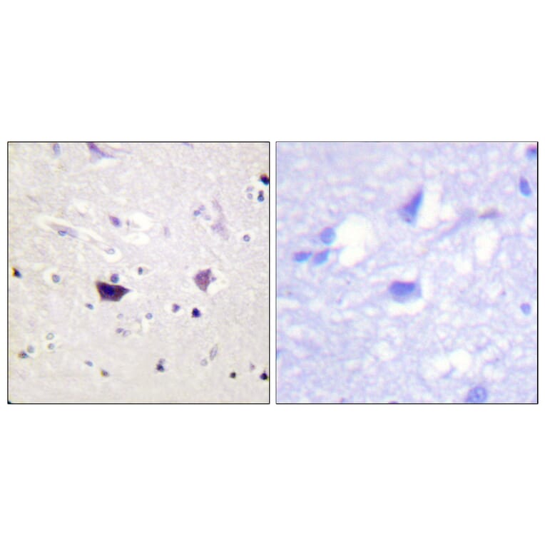 Immunohistochemistry - Anti-PAK1 + PAK2 + PAK3 Antibody (B0541) - Antibodies.com