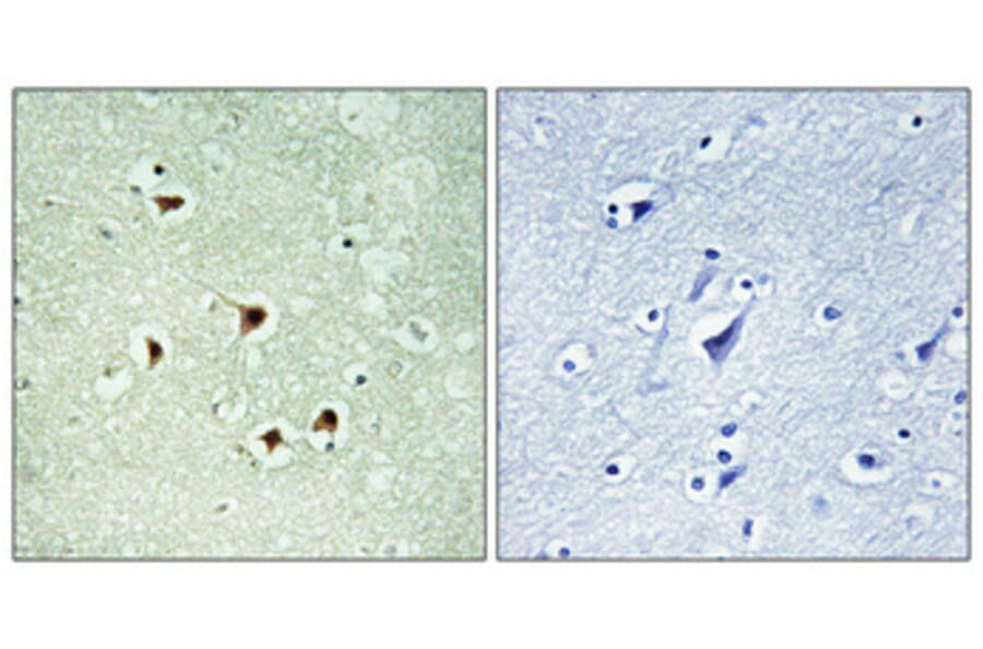 Immunohistochemistry - Anti-MAX (phospho Ser2) Antibody (A1096) - Antibodies.com