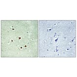 Immunohistochemistry - Anti-MAX (phospho Ser2) Antibody (A1096) - Antibodies.com