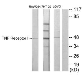 Western Blot - Anti-TNF Receptor II Antibody (C10436) - Antibodies.com