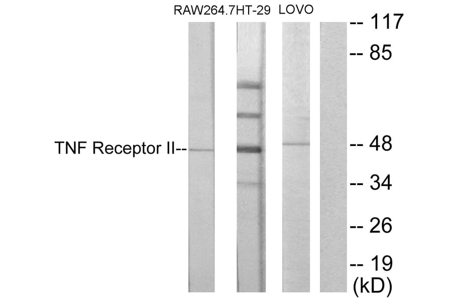 Western Blot - Anti-TNF Receptor II Antibody (C10436) - Antibodies.com