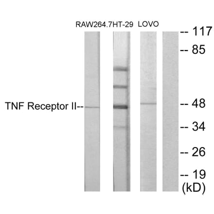 Western Blot - Anti-TNF Receptor II Antibody (C10436) - Antibodies.com