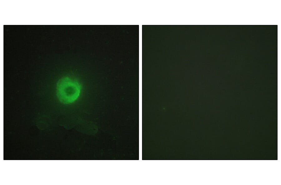 Immunofluorescence - Anti-TNF Receptor II Antibody (C10436) - Antibodies.com