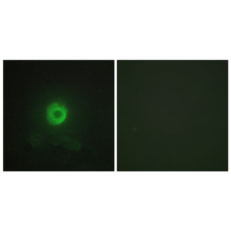 Immunofluorescence - Anti-TNF Receptor II Antibody (C10436) - Antibodies.com