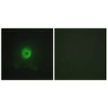 Immunofluorescence - Anti-TNF Receptor II Antibody (C10436) - Antibodies.com