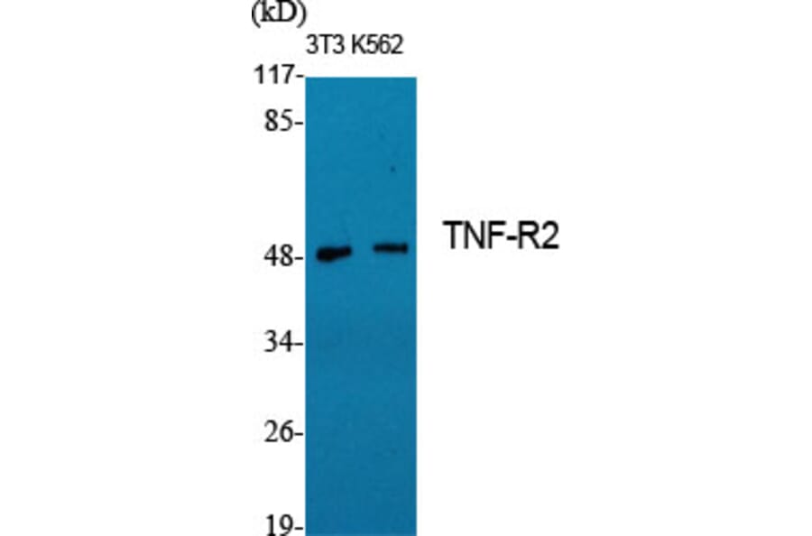 Western Blot - Anti-TNF Receptor II Antibody (C10436) - Antibodies.com