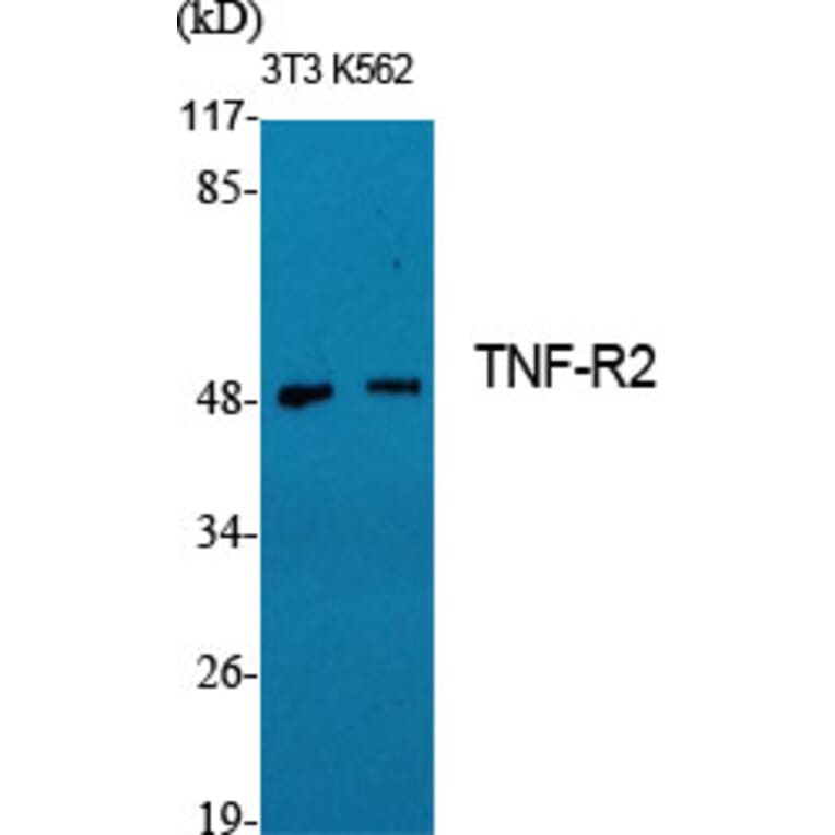 Western Blot - Anti-TNF Receptor II Antibody (C10436) - Antibodies.com