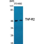 Western Blot - Anti-TNF Receptor II Antibody (C10436) - Antibodies.com