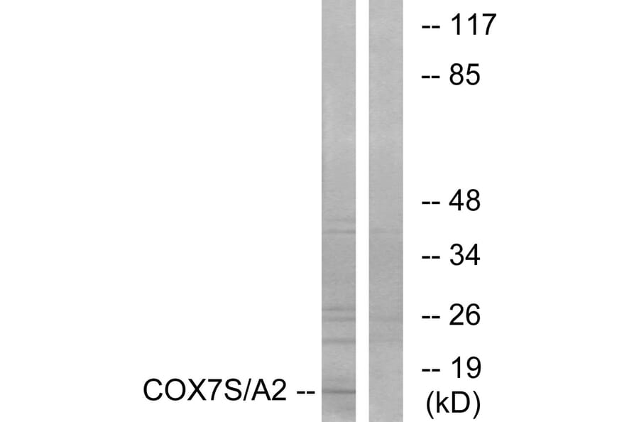 Western Blot - Anti-COX7S + COX7A2 Antibody (C12243) - Antibodies.com