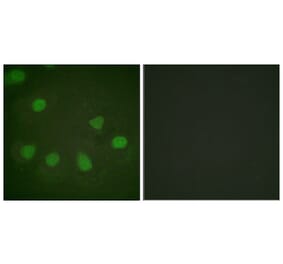 Immunofluorescence - Anti-Retinoblastoma Antibody (B0982) - Antibodies.com