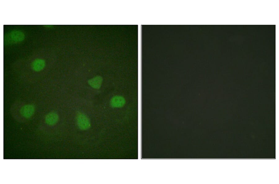 Immunofluorescence - Anti-Retinoblastoma Antibody (B0982) - Antibodies.com