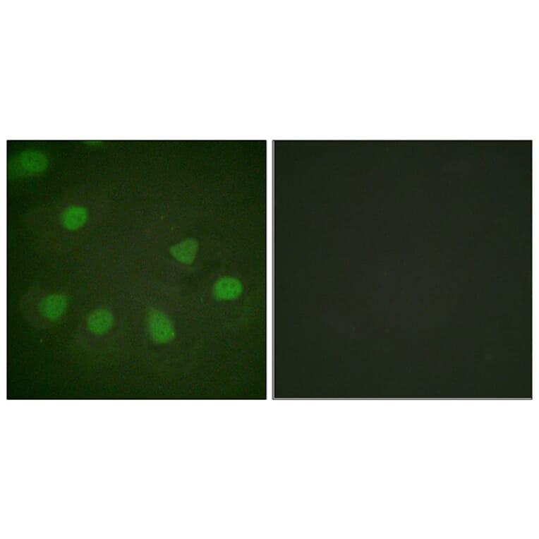 Immunofluorescence - Anti-Retinoblastoma Antibody (B0982) - Antibodies.com