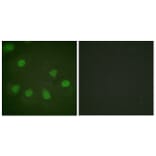 Immunofluorescence - Anti-Retinoblastoma Antibody (B0982) - Antibodies.com