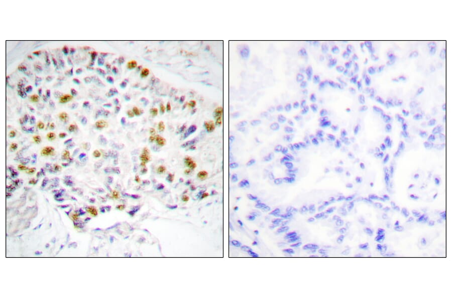 Immunohistochemistry - Anti-Retinoblastoma Antibody (B0982) - Antibodies.com