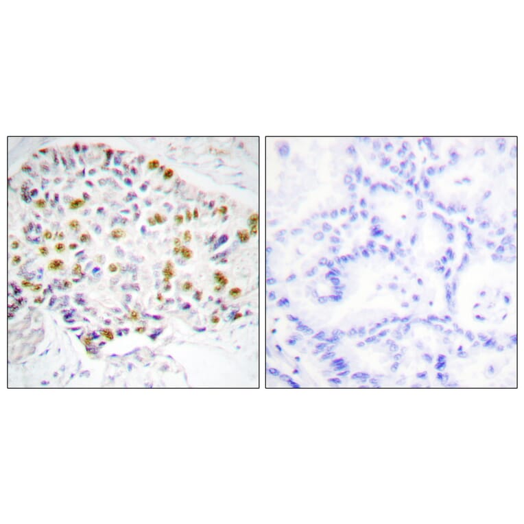 Immunohistochemistry - Anti-Retinoblastoma Antibody (B0982) - Antibodies.com