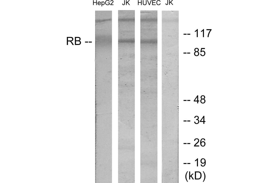 Western Blot - Anti-Retinoblastoma Antibody (B7208) - Antibodies.com