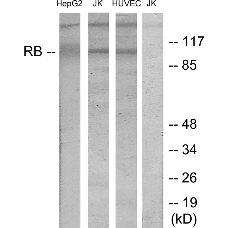 Western Blot - Anti-Retinoblastoma Antibody (B7208) - Antibodies.com