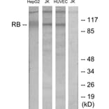 Western Blot - Anti-Retinoblastoma Antibody (B7208) - Antibodies.com