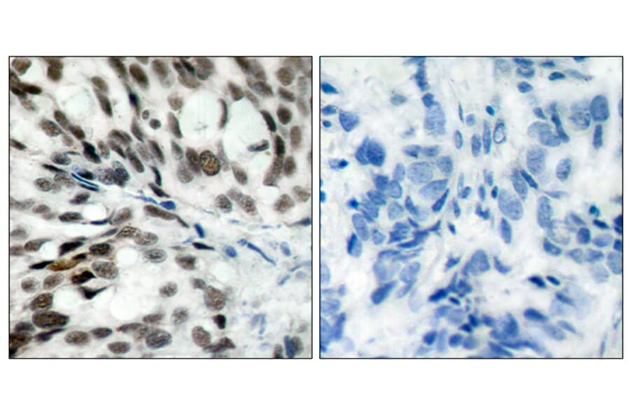 Immunohistochemistry - Anti-Retinoblastoma Antibody (B7208) - Antibodies.com