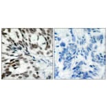 Immunohistochemistry - Anti-Retinoblastoma Antibody (B7208) - Antibodies.com