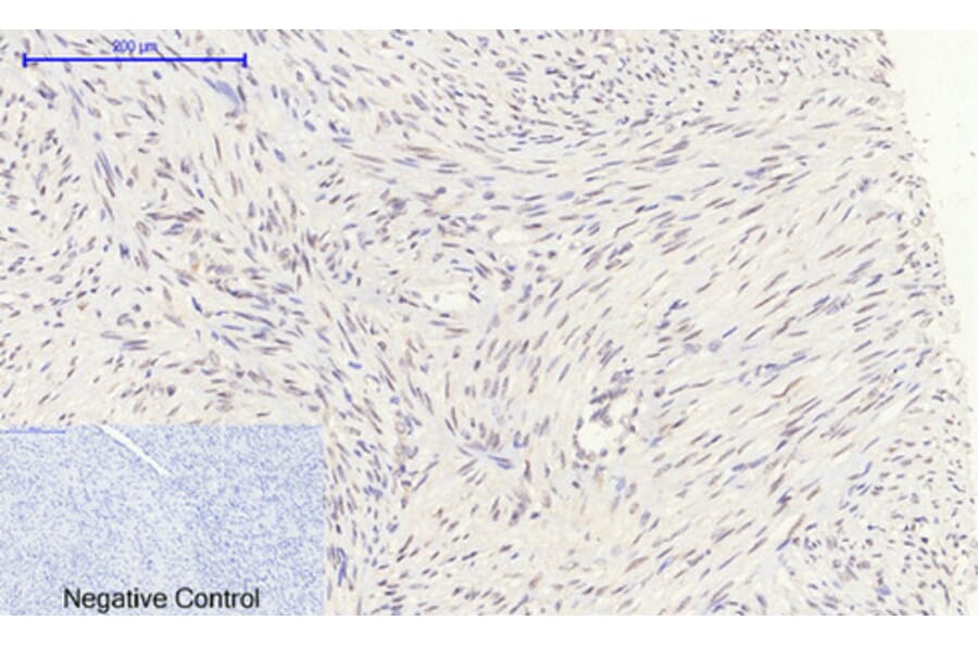 Immunohistochemistry - Anti-Retinoblastoma Antibody (B7208) - Antibodies.com