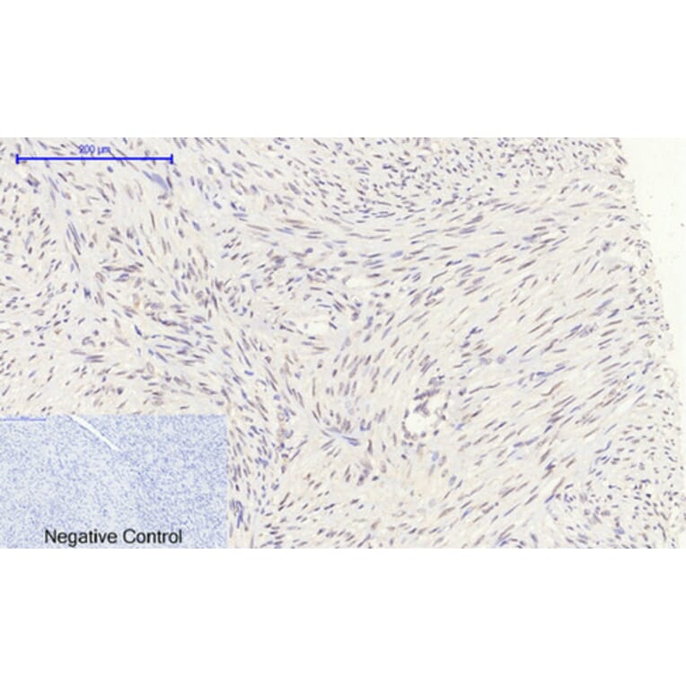 Immunohistochemistry - Anti-Retinoblastoma Antibody (B7208) - Antibodies.com