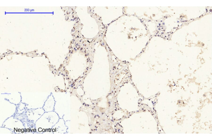 Immunohistochemistry - Anti-Retinoblastoma Antibody (B7208) - Antibodies.com
