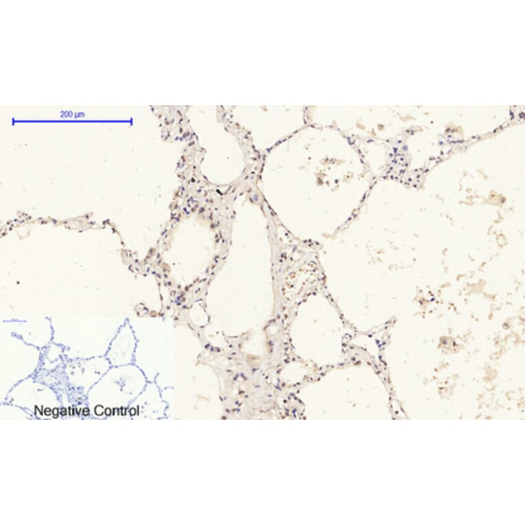 Immunohistochemistry - Anti-Retinoblastoma Antibody (B7208) - Antibodies.com