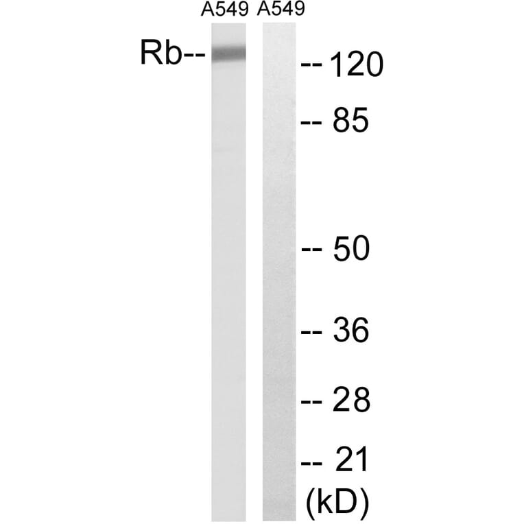 Western Blot - Anti-Retinoblastoma Antibody (B8057) - Antibodies.com