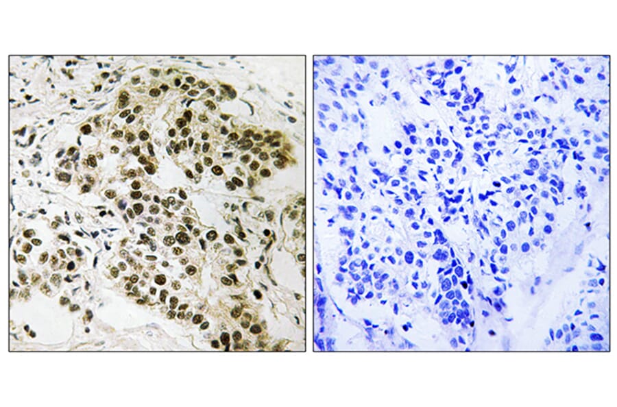 Immunohistochemistry - Anti-Retinoblastoma Antibody (B8057) - Antibodies.com
