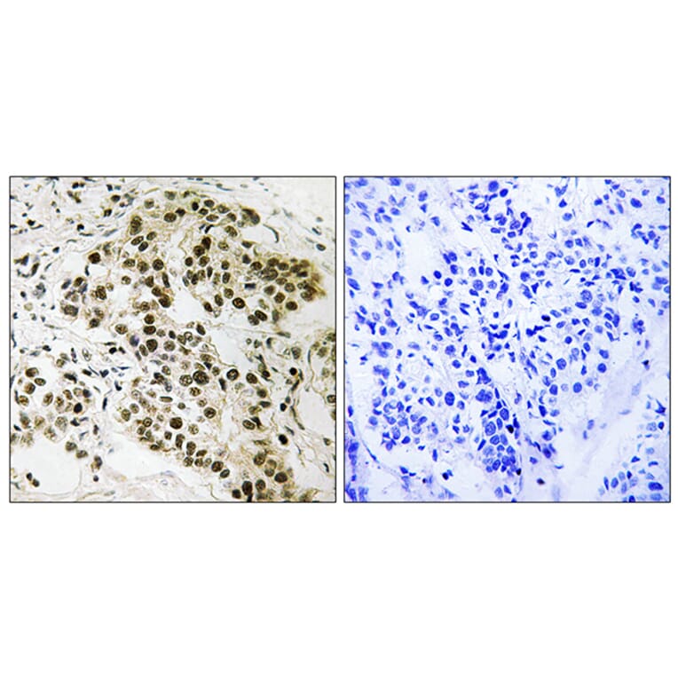 Immunohistochemistry - Anti-Retinoblastoma Antibody (B8057) - Antibodies.com