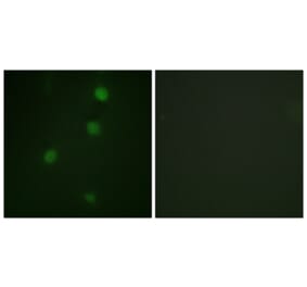 Immunofluorescence - Anti-Retinoblastoma Antibody (B0811) - Antibodies.com