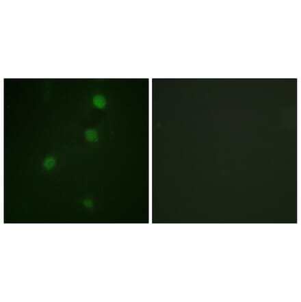 Immunofluorescence - Anti-Retinoblastoma Antibody (B0811) - Antibodies.com