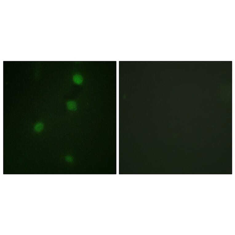 Immunofluorescence - Anti-Retinoblastoma Antibody (B0811) - Antibodies.com
