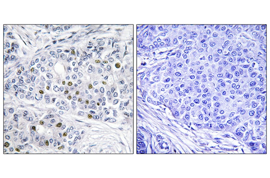 Immunohistochemistry - Anti-Retinoblastoma Antibody (B0811) - Antibodies.com