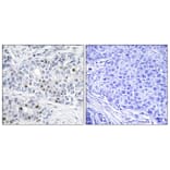 Immunohistochemistry - Anti-Retinoblastoma Antibody (B0811) - Antibodies.com