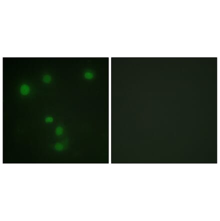 Immunofluorescence - Anti-Retinoblastoma Antibody (B0984) - Antibodies.com