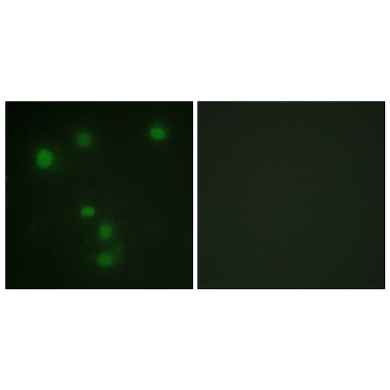 Immunofluorescence - Anti-Retinoblastoma Antibody (B0984) - Antibodies.com