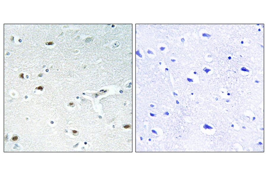 Immunohistochemistry - Anti-Retinoblastoma Antibody (B0984) - Antibodies.com