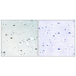 Immunohistochemistry - Anti-Retinoblastoma Antibody (B0984) - Antibodies.com