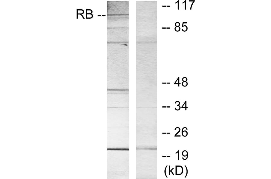 Western Blot - Anti-Retinoblastoma Antibody (B7210) - Antibodies.com