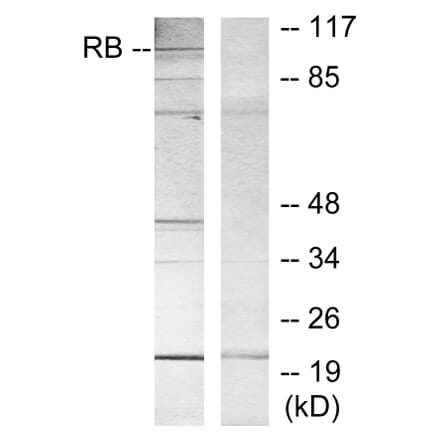 Western Blot - Anti-Retinoblastoma Antibody (B7210) - Antibodies.com