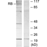 Western Blot - Anti-Retinoblastoma Antibody (B7210) - Antibodies.com