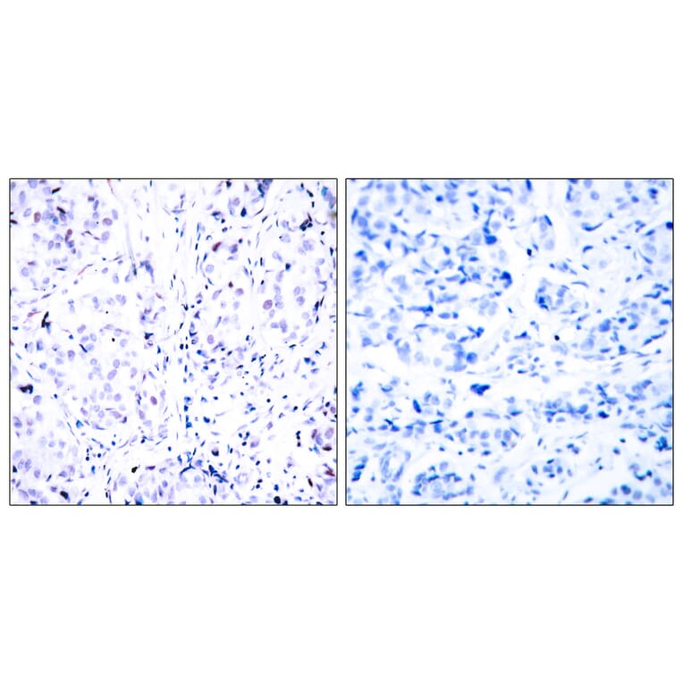 Immunohistochemistry - Anti-Retinoblastoma Antibody (B7210) - Antibodies.com