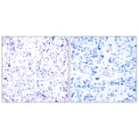 Immunohistochemistry - Anti-Retinoblastoma Antibody (B7210) - Antibodies.com