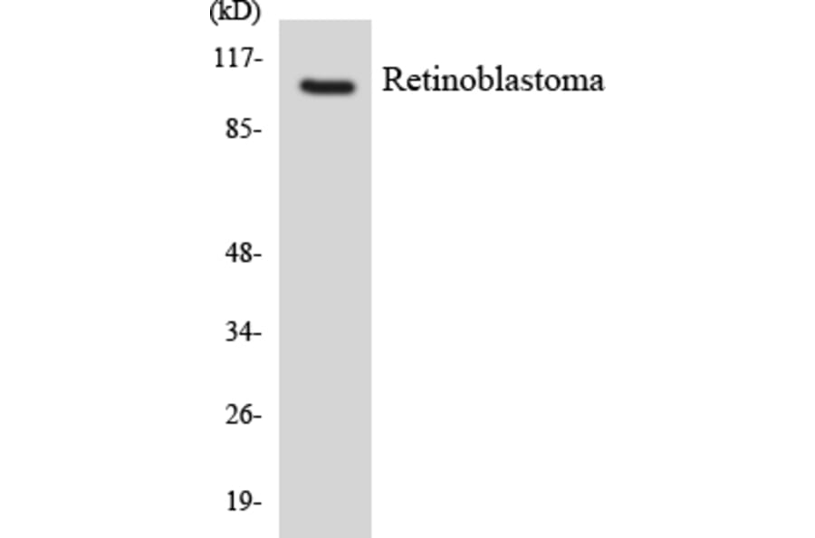 Western Blot - Anti-Retinoblastoma Antibody (R12-3423) - Antibodies.com