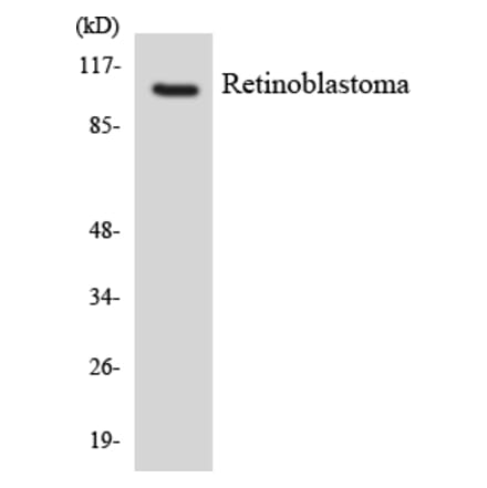 Western Blot - Anti-Retinoblastoma Antibody (R12-3423) - Antibodies.com