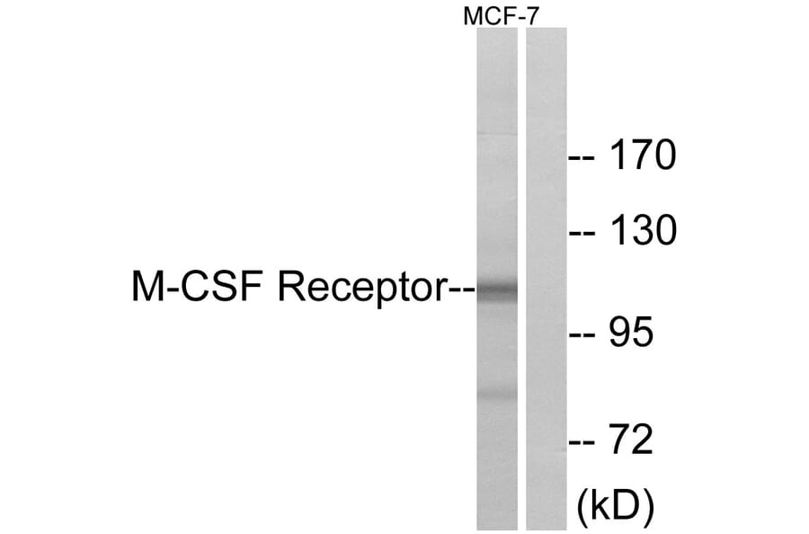 Western Blot - Anti-M-CSF Receptor Antibody (B0679) - Antibodies.com