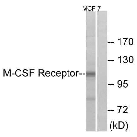 Western Blot - Anti-M-CSF Receptor Antibody (B0679) - Antibodies.com