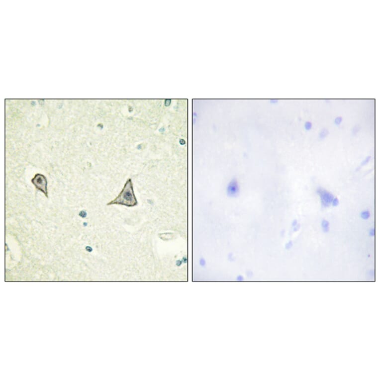 Immunohistochemistry - Anti-M-CSF Receptor Antibody (B0679) - Antibodies.com